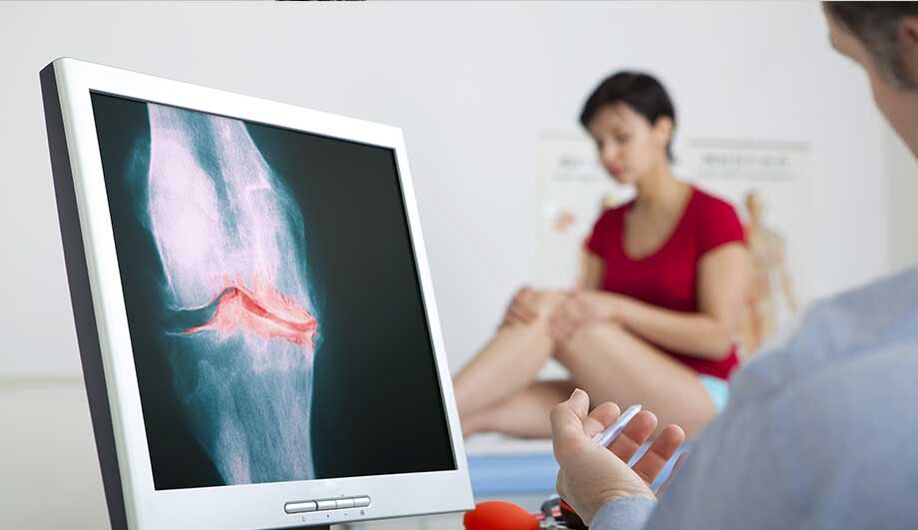 Consulte a un médico si sospecha artritis u osteoartritis