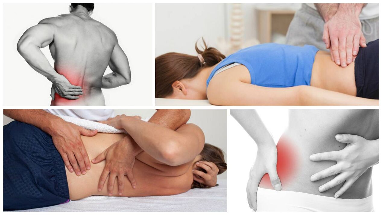Síntomas y causas del dolor de espalda
