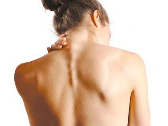 La niña sufre de osteocondrosis cervical.