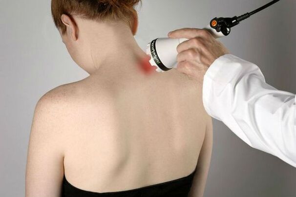 medidas fisioterapéuticas para el tratamiento de la osteocondrosis cervical