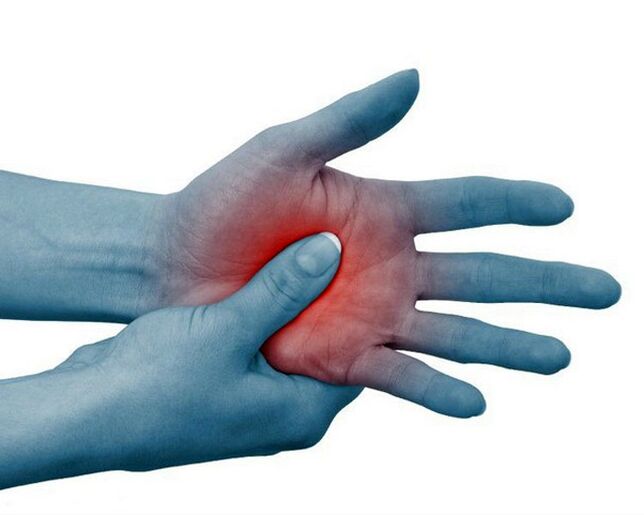 El dolor intenso en las articulaciones de los dedos que mejora con la actividad física es un signo típico de artritis reumatoide.